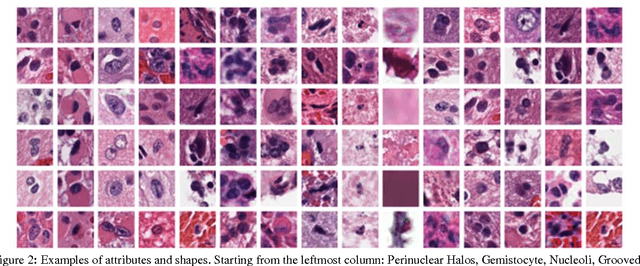 Figure 3 for Center-Focusing Multi-task CNN with Injected Features for Classification of Glioma Nuclear Images