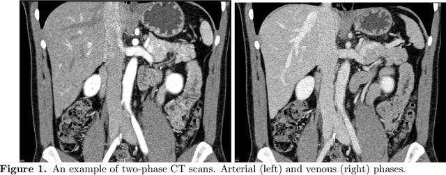 Figure 1 for Multi-phase Deformable Registration for Time-dependent Abdominal Organ Variations