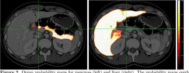 Figure 2 for Multi-phase Deformable Registration for Time-dependent Abdominal Organ Variations