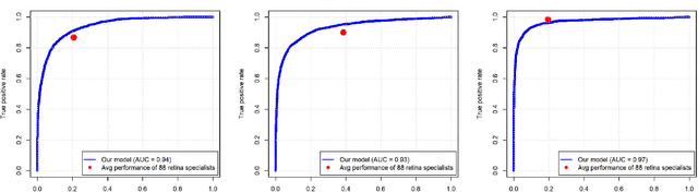 Figure 4 for DeepSeeNet: A deep learning model for automated classification of patient-based age-related macular degeneration severity from color fundus photographs