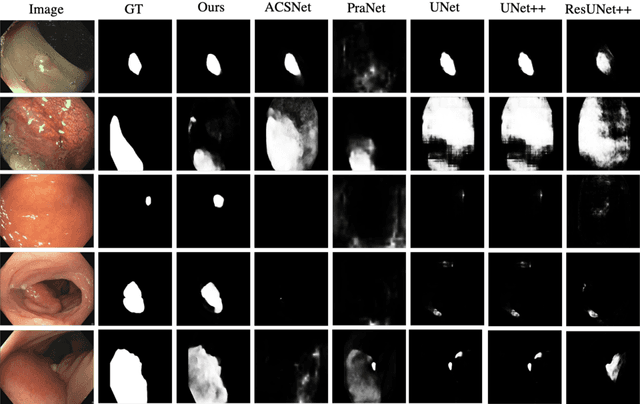 Figure 4 for Duplex Contextual Relation Network for Polyp Segmentation