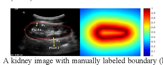 Figure 3 for Fully-automatic segmentation of kidneys in clinical ultrasound images using a boundary distance regression network