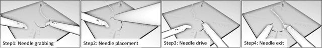 Figure 1 for Towards Augmented Reality-based Suturing in Monocular Laparoscopic Training