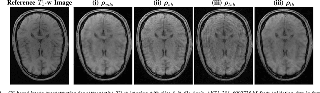 Figure 2 for Learning the sampling density in 2D SPARKLING MRI acquisition for optimized image reconstruction