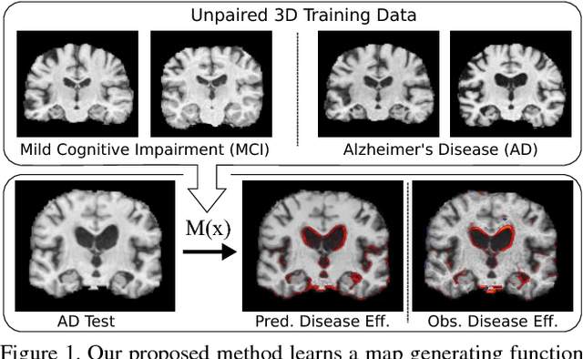 Figure 1 for Visual Feature Attribution using Wasserstein GANs