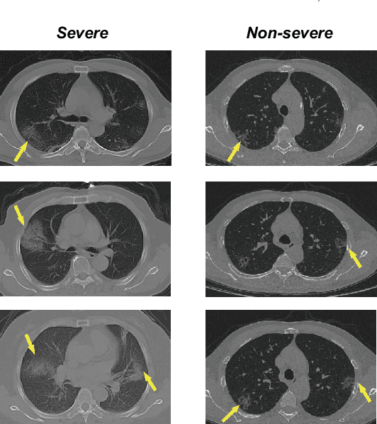 Figure 1 for A novel multiple instance learning framework for COVID-19 severity assessment via data augmentation and self-supervised learning