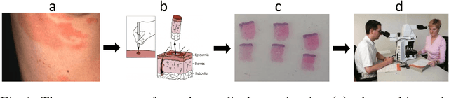 Figure 1 for Semantic Segmentation of Histopathological Slides for the Classification of Cutaneous Lymphoma and Eczema