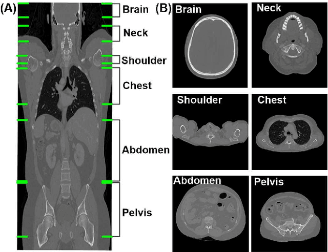 Figure 1 for How much data is needed to train a medical image deep learning system to achieve necessary high accuracy?