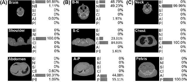 Figure 3 for How much data is needed to train a medical image deep learning system to achieve necessary high accuracy?