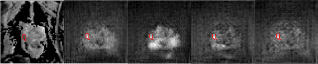 Figure 1 for Harnessing Uncertainty in Domain Adaptation for MRI Prostate Lesion Segmentation