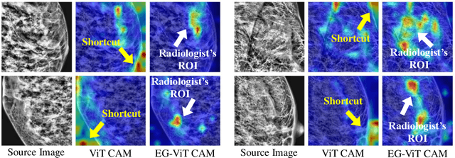Figure 1 for Eye-gaze-guided Vision Transformer for Rectifying Shortcut Learning