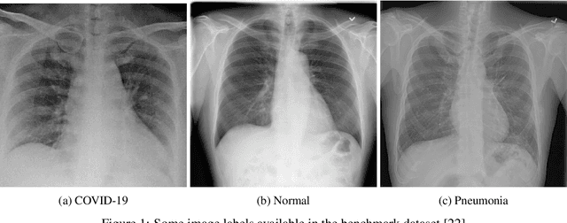 Figure 2 for ECOVNet: An Ensemble of Deep Convolutional Neural Networks Based on EfficientNet to Detect COVID-19 From Chest X-rays