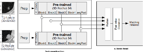 Figure 2 for Re-Identification and Growth Detection of Pulmonary Nodules without Image Registration Using 3D Siamese Neural Networks