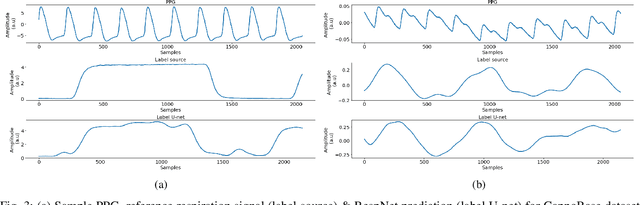 Figure 3 for RespNet: A deep learning model for extraction of respiration from photoplethysmogram