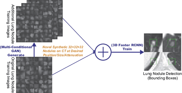 Figure 1 for Synthesizing Diverse Lung Nodules Wherever Massively: 3D Multi-Conditional GAN-based CT Image Augmentation for Object Detection