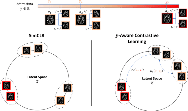 Figure 1 for Contrastive Learning with Continuous Proxy Meta-Data for 3D MRI Classification