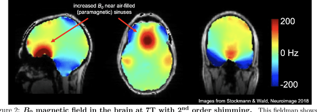 Figure 2 for Off-resonance artifact correction for magnetic resonance imaging: a review