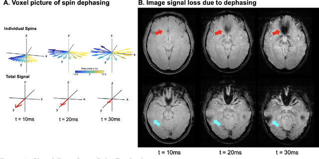 Figure 4 for Off-resonance artifact correction for magnetic resonance imaging: a review
