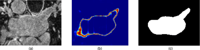 Figure 1 for Semi-supervised Medical Image Segmentation via Geometry-aware Consistency Training