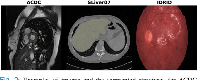 Figure 2 for GANs for Medical Image Synthesis: An Empirical Study