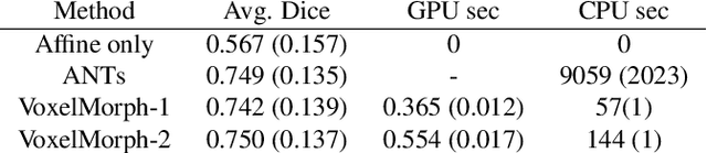 Figure 2 for An Unsupervised Learning Model for Deformable Medical Image Registration