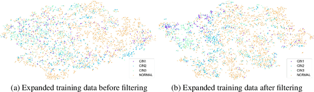 Figure 4 for Synthetic Augmentation and Feature-based Filtering for Improved Cervical Histopathology Image Classification