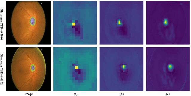 Figure 4 for Combating Ambiguity for Hash-code Learning in Medical Instance Retrieval