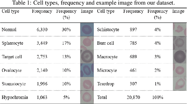 Figure 1 for Analysis of Vision-based Abnormal Red Blood Cell Classification