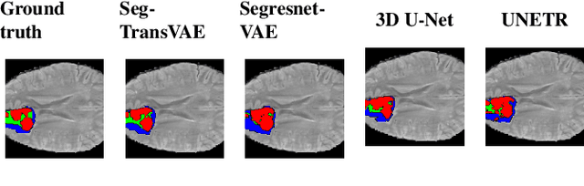 Figure 3 for SegTransVAE: Hybrid CNN -- Transformer with Regularization for medical image segmentation