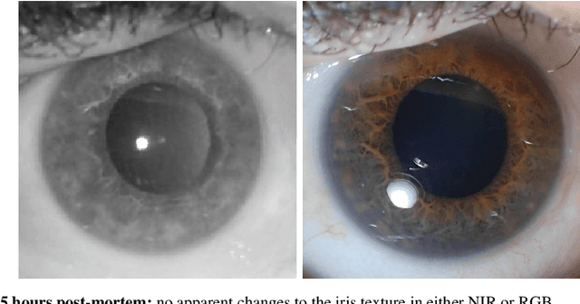 Figure 1 for Post-mortem Iris Decomposition and its Dynamics in Morgue Conditions