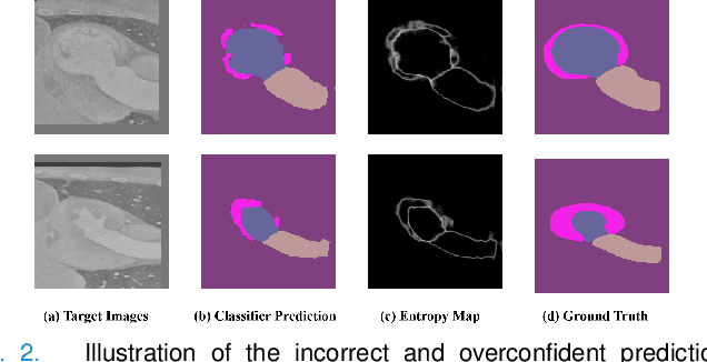 Figure 3 for Margin Preserving Self-paced Contrastive Learning Towards Domain Adaptation for Medical Image Segmentation