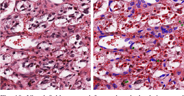 Figure 2 for PanNuke Dataset Extension, Insights and Baselines
