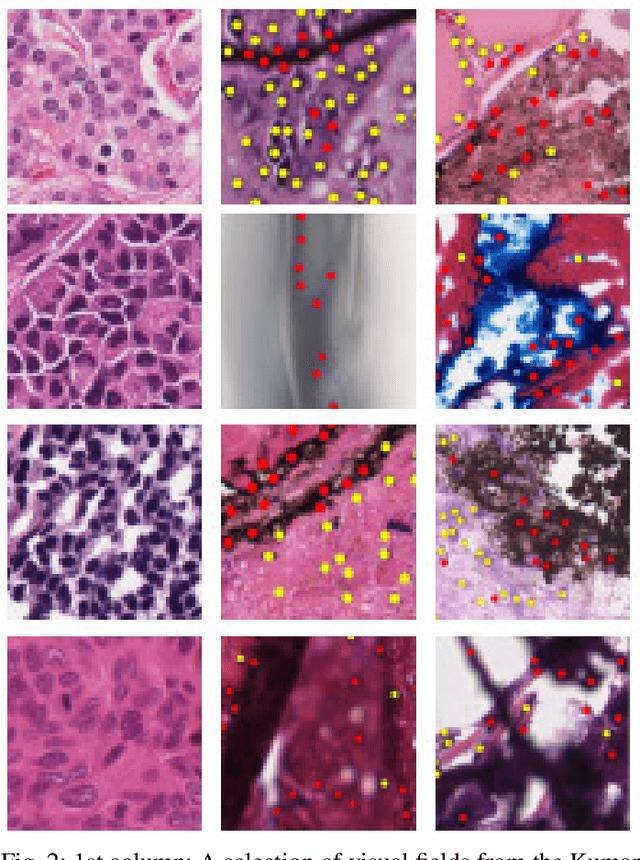 Figure 4 for PanNuke Dataset Extension, Insights and Baselines