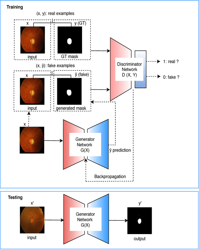 Figure 3 for Retinal Optic Disc Segmentation using Conditional Generative Adversarial Network