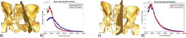 Figure 1 for Exploiting Partial Structural Symmetry For Patient-Specific Image Augmentation in Trauma Interventions