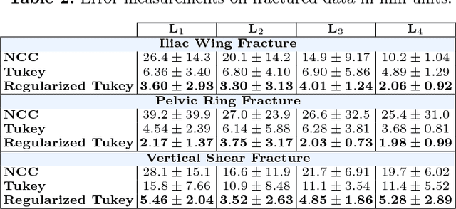 Figure 4 for Exploiting Partial Structural Symmetry For Patient-Specific Image Augmentation in Trauma Interventions