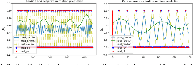 Figure 3 for Repetitive Motion Estimation Network: Recover cardiac and respiratory signal from thoracic imaging