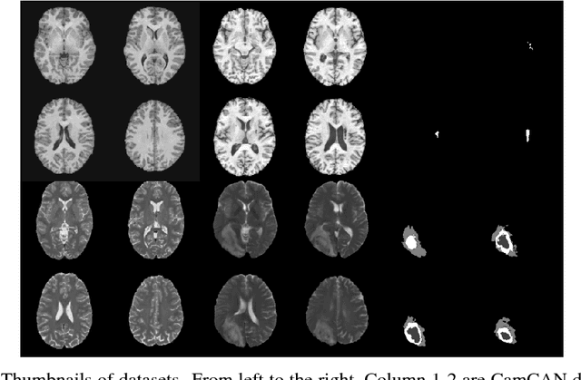 Figure 1 for Deep Generative Models in the Real-World: An Open Challenge from Medical Imaging