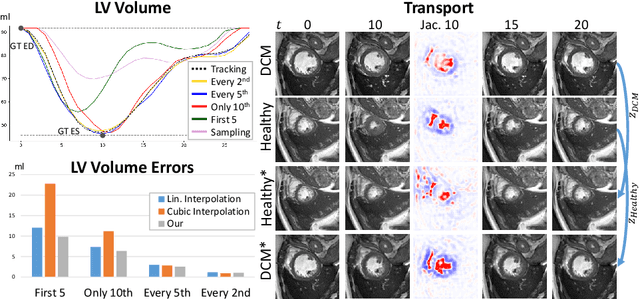 Figure 4 for Probabilistic Motion Modeling from Medical Image Sequences: Application to Cardiac Cine-MRI