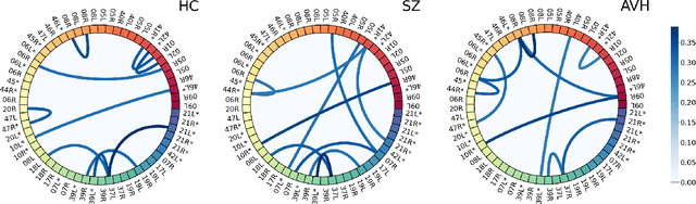 Figure 2 for Investigating Brain Connectivity with Graph Neural Networks and GNNExplainer