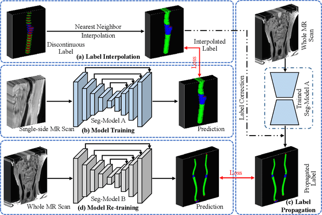 Figure 1 for Label Propagation for 3D Carotid Vessel Wall Segmentation and Atherosclerosis Diagnosis