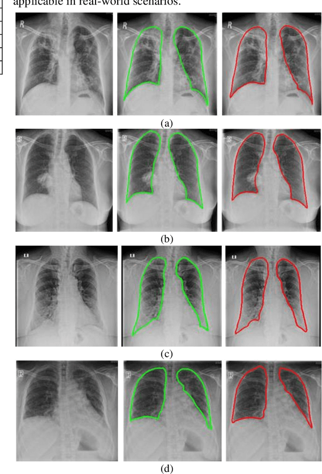 Figure 3 for Deep LF-Net: Semantic Lung Segmentation from Indian Chest Radiographs Including Severely Unhealthy Images