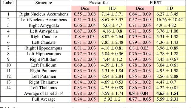 Figure 4 for Sub-cortical structure segmentation database for young population