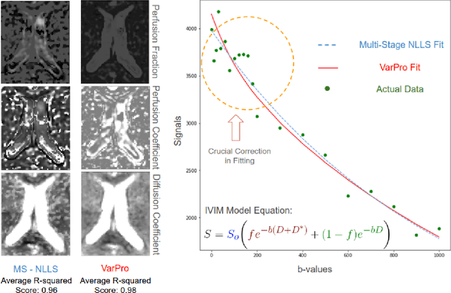 Figure 4 for Fitting IVIM with Variable Projection and Simplicial Optimization