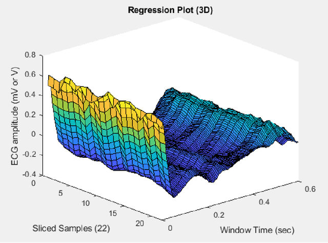 Figure 1 for An Enhanced Electrocardiogram Biometric Authentication System Using Machine Learning