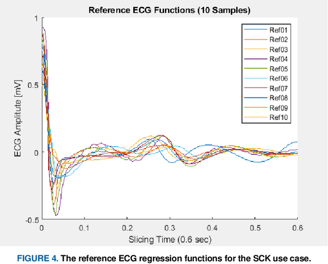 Figure 4 for An Enhanced Electrocardiogram Biometric Authentication System Using Machine Learning
