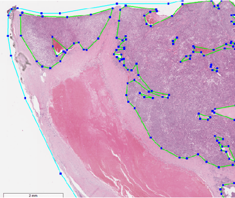 Figure 4 for A Generalized Deep Learning Framework for Whole-Slide Image Segmentation and Analysis