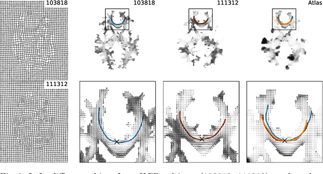 Figure 3 for Structural Connectome Atlas Construction in the Space of Riemannian Metrics
