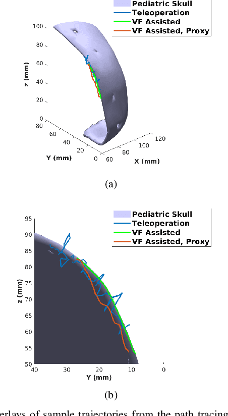 Figure 2 for Anatomical Mesh-Based Virtual Fixtures for Surgical Robots
