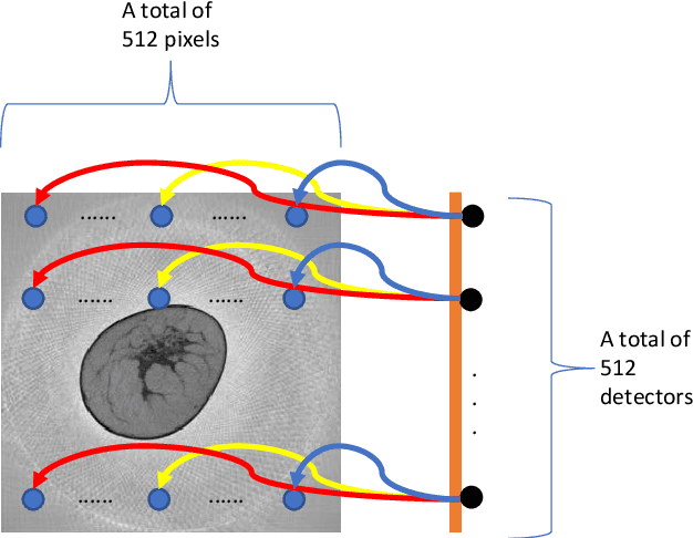 Figure 2 for Deep Efficient End-to-end Reconstruction (DEER) Network for Low-dose Few-view Breast CT from Projection Data